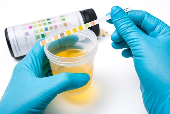 Check-up. Medical report and urine test strips - Image Copyright: Alexander Raths